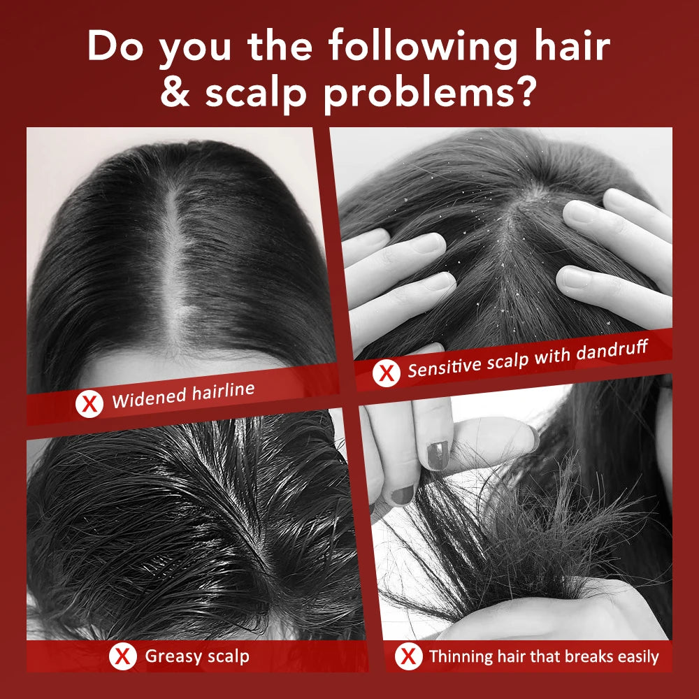 Peigne de Massage Électrique avec Thérapie par Lumière Rouge et Vibration – Brosse de Cuir Chevelu pour la Pousse des Cheveux, Anti-Chute, Applicateur d’Huile ou de Sérum Capillaire