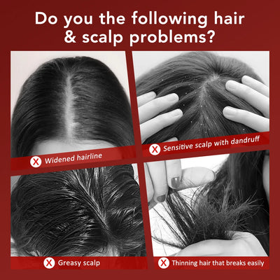 Peigne de Massage Électrique avec Thérapie par Lumière Rouge et Vibration – Brosse de Cuir Chevelu pour la Pousse des Cheveux, Anti-Chute, Applicateur d’Huile ou de Sérum Capillaire